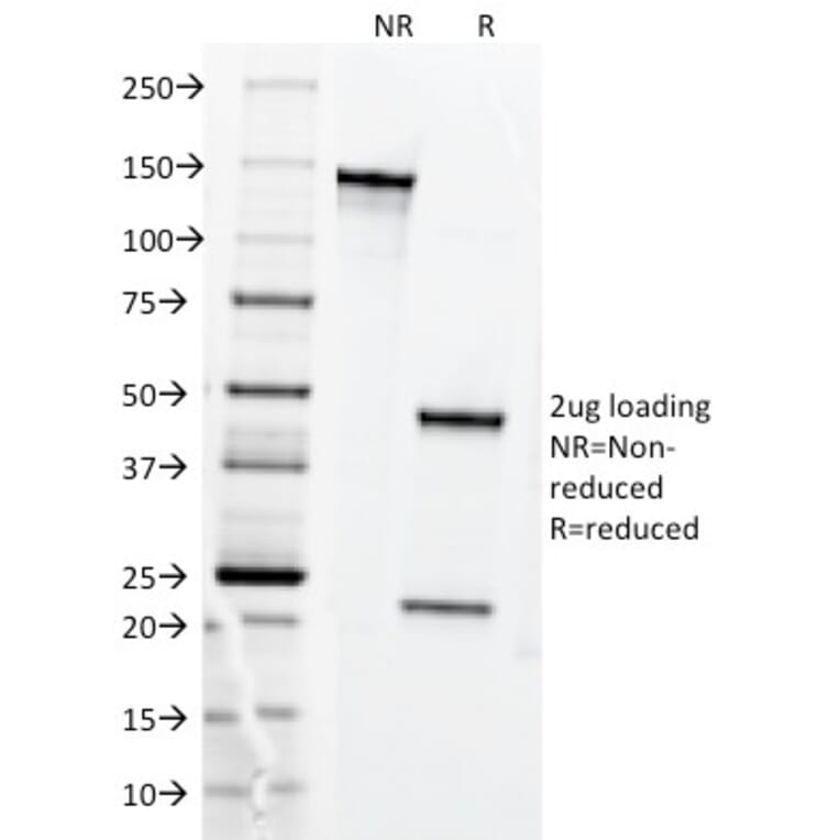 SDS-PAGE - Anti-Transferrin Receptor Antibody [DF1513] (A250092) - Antibodies.com