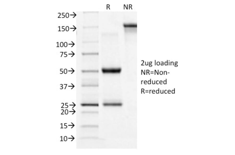 SDS-PAGE - Anti-Transferrin Receptor Antibody [TFRC/1396] (A250096) - Antibodies.com