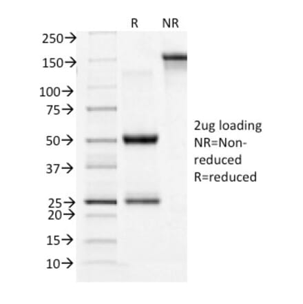 SDS-PAGE - Anti-Transferrin Receptor Antibody [TFRC/1396] (A250096) - Antibodies.com
