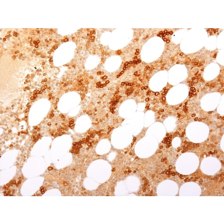 Immunohistochemistry - Anti-Transferrin Receptor Antibody [TFRC/1817] (A250096) - Antibodies.com