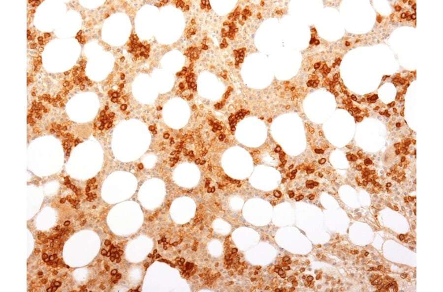 Immunohistochemistry - Anti-Transferrin Receptor Antibody [TFRC/1818] (A250097) - Antibodies.com