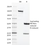 SDS-PAGE - Anti-Transferrin Receptor Antibody [TFRC/1818] (A250098) - Antibodies.com