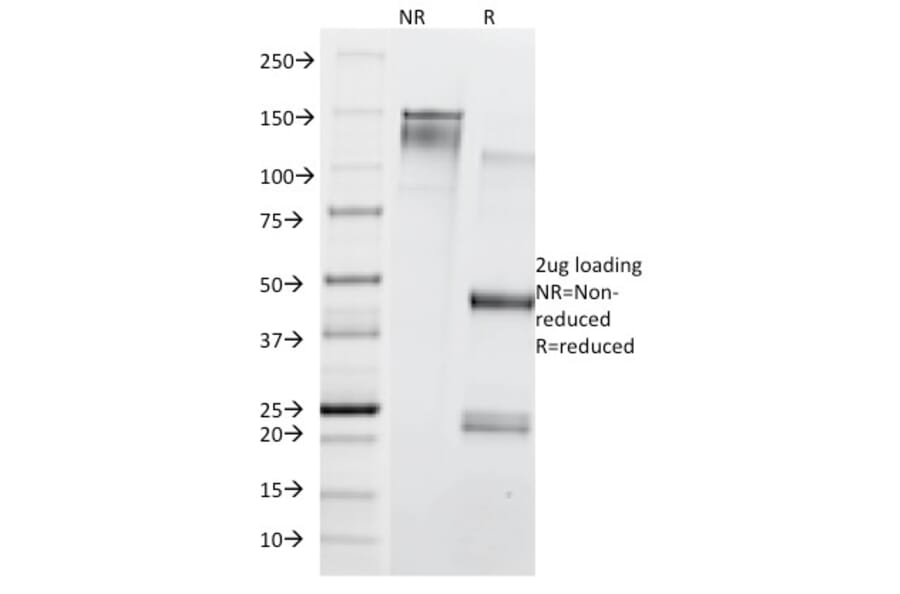 SDS-PAGE - Anti-Transferrin Receptor Antibody [TFRC/1839] (A250099) - Antibodies.com
