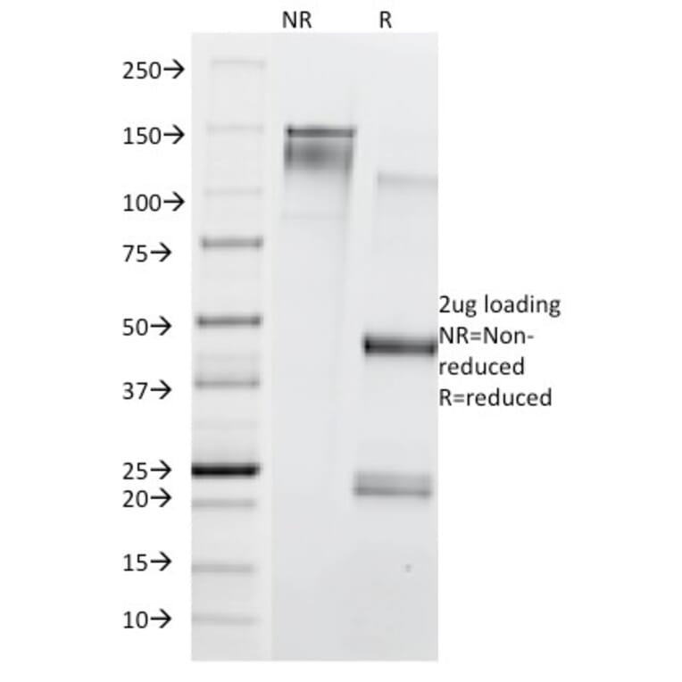 SDS-PAGE - Anti-Transferrin Receptor Antibody [TFRC/1839] (A250099) - Antibodies.com