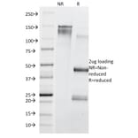 SDS-PAGE - Anti-Transferrin Receptor Antibody [TFRC/1839] (A250099) - Antibodies.com