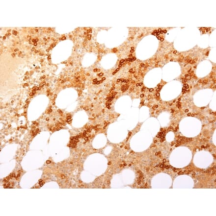 Immunohistochemistry - Anti-Transferrin Receptor Antibody [TFRC/2898R] (A250099) - Antibodies.com