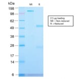 SDS-PAGE - Anti-Transferrin Receptor Antibody [TFRC/2898R] (A250100) - Antibodies.com
