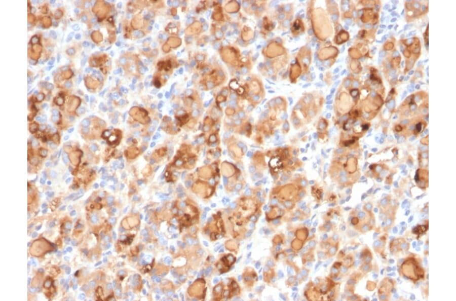 Immunohistochemistry - Anti-Thyroglobulin Antibody [r2H11] (A250101) - Antibodies.com
