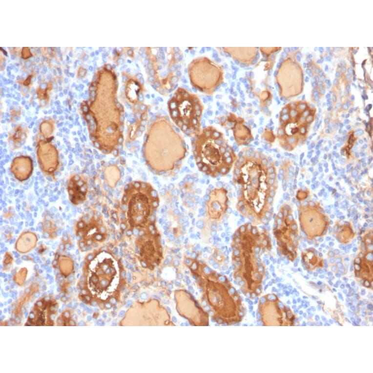 Immunohistochemistry - Anti-Thyroglobulin Antibody [r2H11] (A250100) - Antibodies.com