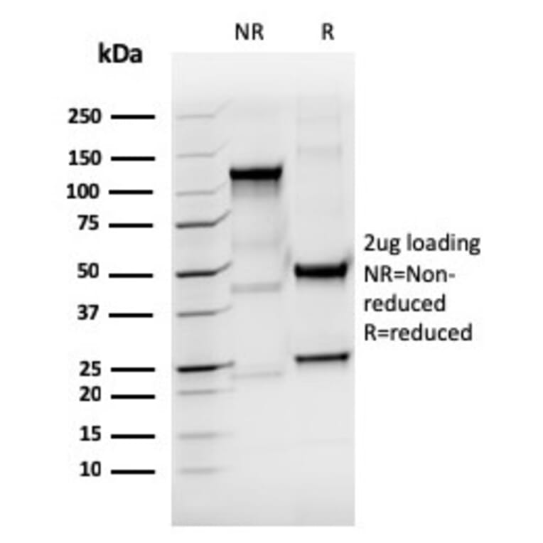 SDS-PAGE - Anti-Thyroglobulin Antibody [rTGB/4744] (A250102) - Antibodies.com
