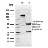 SDS-PAGE - Anti-Thyroglobulin Antibody [rTGB/4744] (A250102) - Antibodies.com