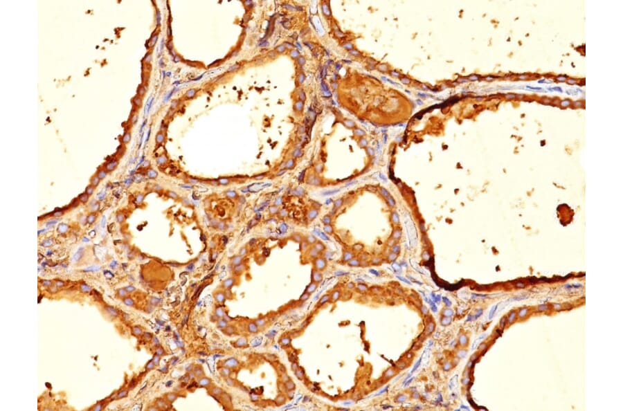 Immunohistochemistry - Anti-Thyroglobulin Antibody [6E1] (A250104) - Antibodies.com