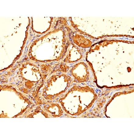 Immunohistochemistry - Anti-Thyroglobulin Antibody [6E1] (A250104) - Antibodies.com