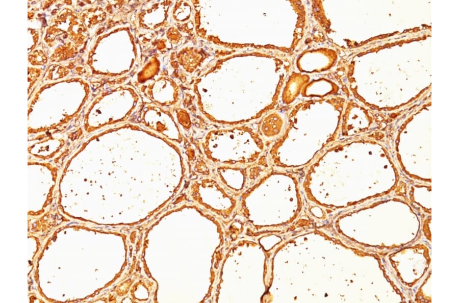 Immunohistochemistry - Anti-Thyroglobulin Antibody [SPM517] (A250105) - Antibodies.com
