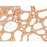 Immunohistochemistry - Anti-Thyroglobulin Antibody [SPM517] (A250105) - Antibodies.com
