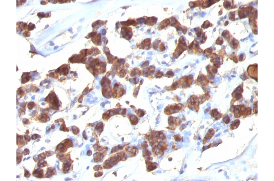Immunohistochemistry - Anti-Thyroglobulin Antibody [2H11 + 6E1] (A250106) - Antibodies.com