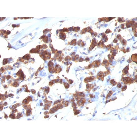 Immunohistochemistry - Anti-Thyroglobulin Antibody [2H11 + 6E1] (A250106) - Antibodies.com