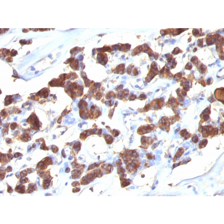 Immunohistochemistry - Anti-Thyroglobulin Antibody [2H11 + 6E1] (A250106) - Antibodies.com