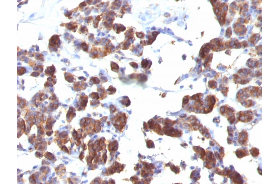 Immunohistochemistry - Anti-Thyroglobulin Antibody [TGB04 + TGB05] (A250107) - Antibodies.com