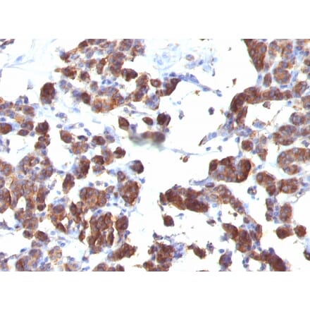 Immunohistochemistry - Anti-Thyroglobulin Antibody [TGB04 + TGB05] (A250107) - Antibodies.com