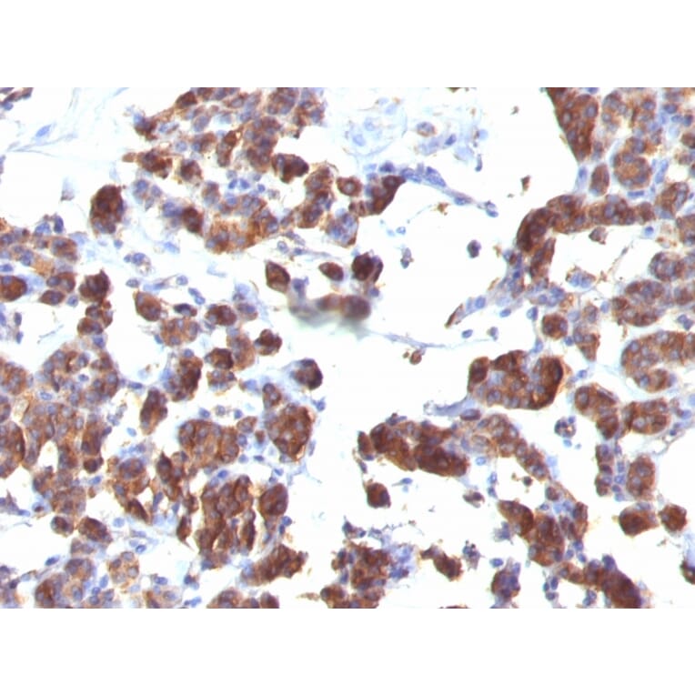 Immunohistochemistry - Anti-Thyroglobulin Antibody [TGB04 + TGB05] (A250107) - Antibodies.com
