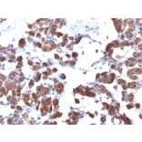 Immunohistochemistry - Anti-Thyroglobulin Antibody [TGB04 + TGB05] (A250107) - Antibodies.com