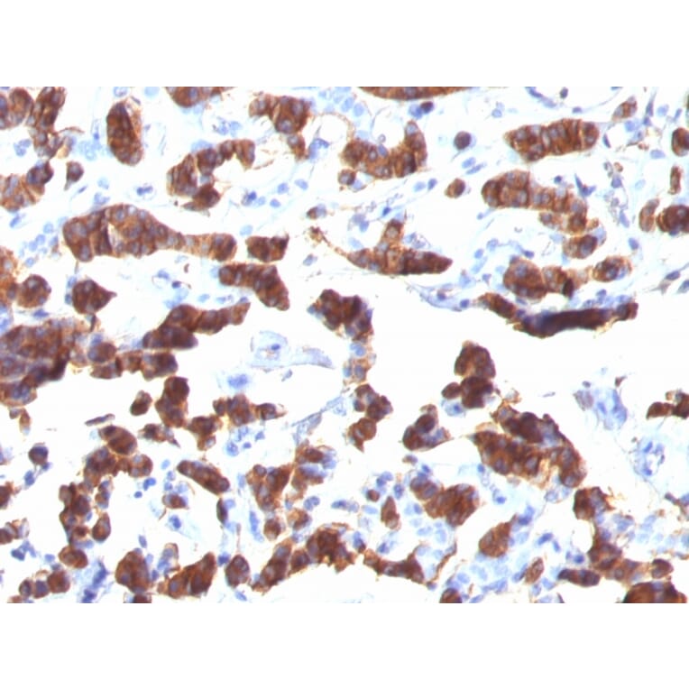 Immunohistochemistry - Anti-Thyroglobulin Antibody [TGB24] (A250108) - Antibodies.com