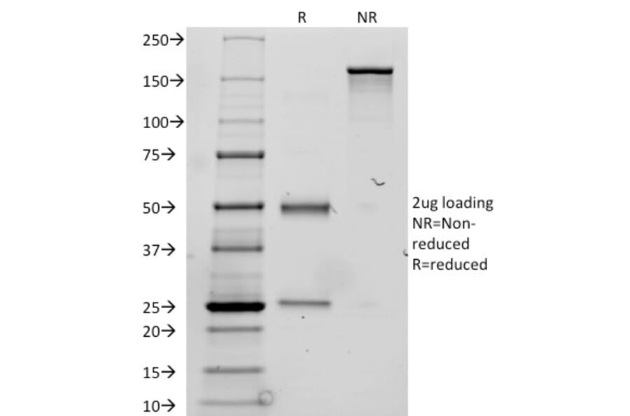 SDS-PAGE - Anti-Thyroglobulin Antibody [TGB24] (A250109) - Antibodies.com