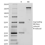 SDS-PAGE - Anti-Thyroglobulin Antibody [TGB24] (A250109) - Antibodies.com