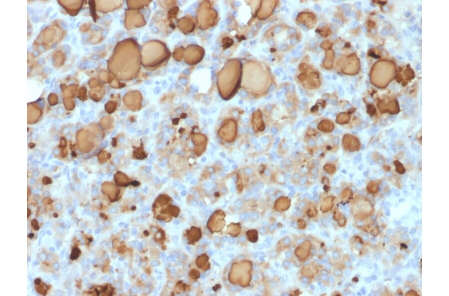 Immunohistochemistry - Anti-Thyroglobulin Antibody [rTGB24] (A250109) - Antibodies.com