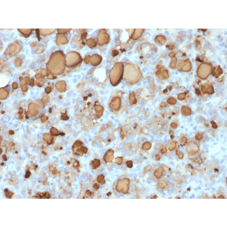 Immunohistochemistry - Anti-Thyroglobulin Antibody [rTGB24] (A250109) - Antibodies.com