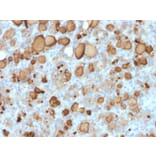 Immunohistochemistry - Anti-Thyroglobulin Antibody [rTGB24] (A250109) - Antibodies.com