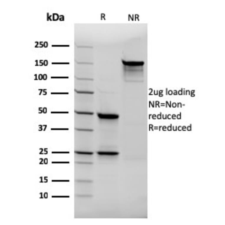 SDS-PAGE - Anti-Thyroglobulin Antibody [rTGB24] (A250110) - Antibodies.com