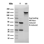 SDS-PAGE - Anti-Thyroglobulin Antibody [rTGB24] (A250110) - Antibodies.com