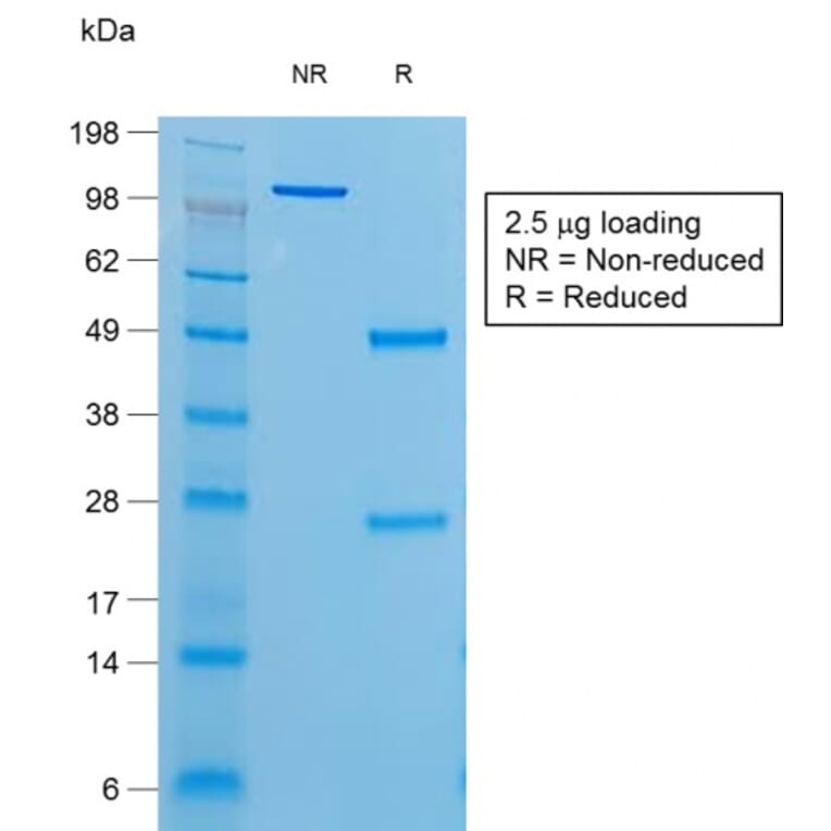 SDS-PAGE - Anti-Thyroglobulin Antibody [r6E1] (A250111) - Antibodies.com