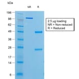 SDS-PAGE - Anti-Thyroglobulin Antibody [r6E1] (A250111) - Antibodies.com