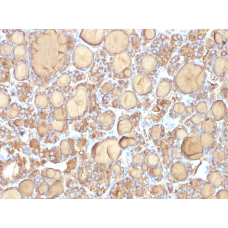 Immunohistochemistry - Anti-Thyroglobulin Antibody [r6E1] (A250110) - Antibodies.com