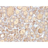 Immunohistochemistry - Anti-Thyroglobulin Antibody [r6E1] (A250110) - Antibodies.com
