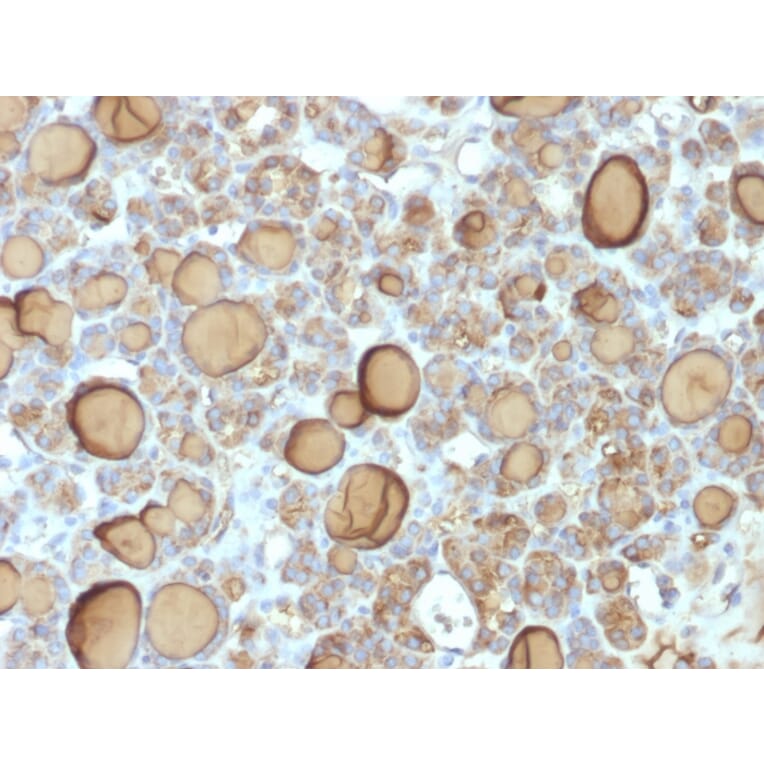 Immunohistochemistry - Anti-Thyroglobulin Antibody [TGB/1970R] (A250111) - Antibodies.com