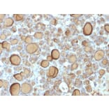 Immunohistochemistry - Anti-Thyroglobulin Antibody [TGB/1970R] (A250111) - Antibodies.com