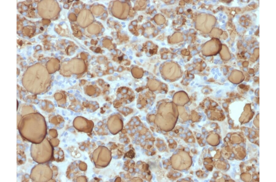 Immunohistochemistry - Anti-Thyroglobulin Antibody [TGB/1968R] (A250112) - Antibodies.com