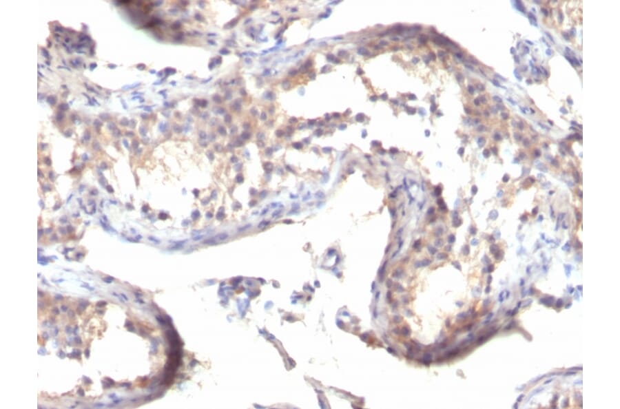 Immunohistochemistry - Anti-TGF alpha Antibody [MF9] (A250113) - Antibodies.com