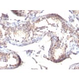 Immunohistochemistry - Anti-TGF alpha Antibody [MF9] (A250113) - Antibodies.com