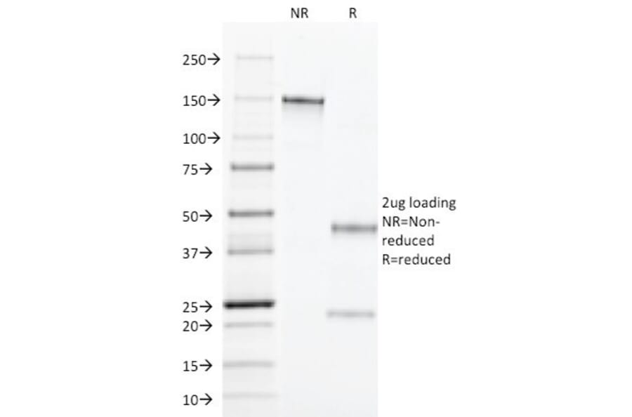 SDS-PAGE - Anti-TGF alpha Antibody [MF9] (A250114) - Antibodies.com