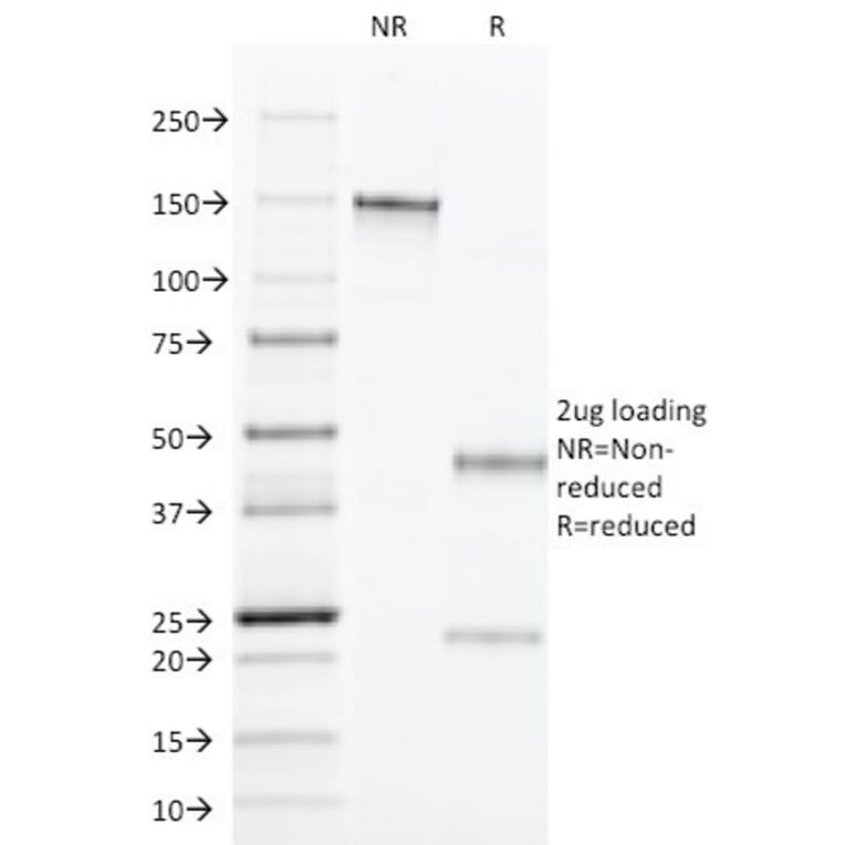 SDS-PAGE - Anti-TGF alpha Antibody [MF9] (A250114) - Antibodies.com