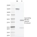 SDS-PAGE - Anti-TGF alpha Antibody [MF9] (A250114) - Antibodies.com