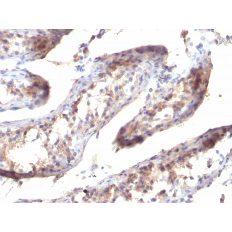 Immunohistochemistry - Anti-TGF alpha Antibody [SPM357] (A250114) - Antibodies.com