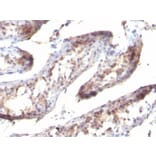 Immunohistochemistry - Anti-TGF alpha Antibody [SPM357] (A250114) - Antibodies.com
