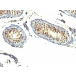 Immunohistochemistry - Anti-TGF alpha Antibody [P/T1] (A250116) - Antibodies.com