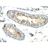 Immunohistochemistry - Anti-TGF alpha Antibody [TG86 + P/T1] (A250117) - Antibodies.com